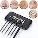 Party Queen Blackhead Remover Tool 6 Pcs Versatile Removal Kit Facial Extractor Treatment for Pimple Acne Comedone Blemish Whitehead Popping