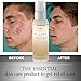 NEW Witch Hazel Rose Scented Primer & Toner to Perfect & Clear Acne-Prone Skin & Tighten Pores with this Astringent, Hydrating and Calming Face Treatment. Travel Size