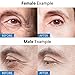 Evagloss Rapid Reduction Eye Cream, Visibly Reduce Under-Eye Bags, wrinkles and fine lines in seconds, for dark circles and fatigued appearance 2Pcsthumb 1