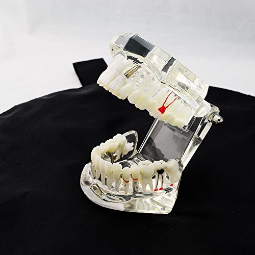 4 Dental+Teaching+Typodont+Removable+ZJ+COSM