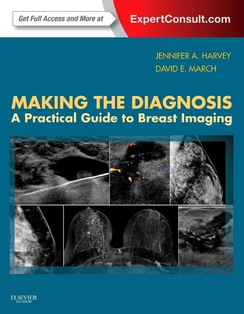 Diagnostic Breast Imaging 第2版 Diagnostic Imaging: Breast: 9780323548120: Medicine & Health