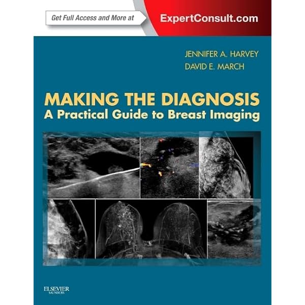 Diagnostic Breast Imaging 第2版 Diagnostic Breast Imaging: Mammography, Sonography, MRI and