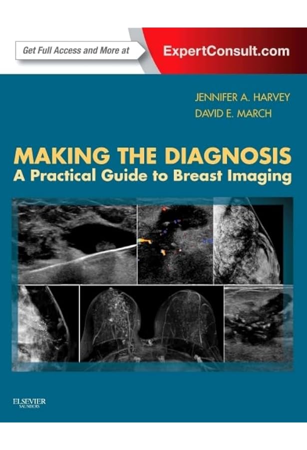 Diagnostic Imaging: Breast: 9780323548120: Medicine & Health