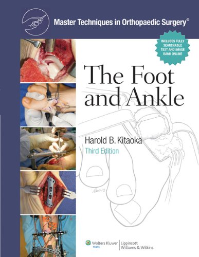 [B.e.s.t] Master Techniques in Orthopaedic Surgery: The Foot and Ankle [K.I.N.D.L.E]