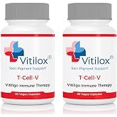 Vitilox Vitiligo T-Cell-V Immune Therapy Capsules &ndash; 4 Months Supply