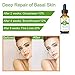Retinol Serum 2.5% Face Skin Care Night Serum for Facial Eye Moisturizer with Pure Hyaluronic Acid,Glycolic Acid,Jojoba Oil & Aloe Vera Help to Anti Aging & Wrinkle, Acne Repair for All Skin-30ml