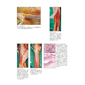 Maku kinmaku : jintai no choÌ„ryoku nettowaÌ„ku saishin chiken to chiryoÌ„ apuroÌ„chi