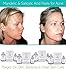 Azarvi 40% Mandelic Acid Peel Including After Peel Neutralizer. Professional Grade Chemical Peel Treatment Ideal For Acne Sufferers