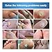 Wart Remover – Plantar Wart Removal – Corn Callus Remover – Professional Removes Common and Plantar Warts, Callus, Stops Wart Regrowththumb 4