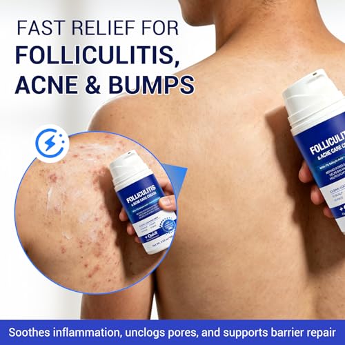 Folliculitis Cream 100g, Multi-Purpose Cream for Oily & Blemish-Prone Skin, Gentle Herbal Care for Smooth, Calm the Look of Redness, help reduce excess oil appearance, Suitable for Scalp, Face & Body