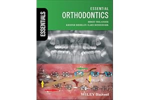 Essential Orthodontics (Essentials (Dentistry))