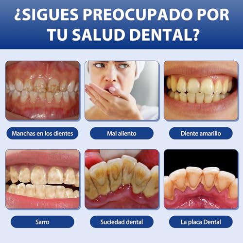 Blanqueador Dental Profesional,Polvos Blanqueadores Dientes,Blanqueamiento Dental Eliminación Profunda de Manchas,Eficaz Para Fortalecer Dientes y Encías,Suave Para Dientes Sensibles(Azul)