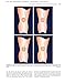 Total Knee Arthroplasty