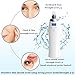 Blackhead Remover, Vacuum Blackhead Suction USB Rechargeable