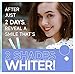 Dr. Brite Stay Brite Teeth Whitening Pen with Mint and Activated Coconut Charcoal (0.07 Fl Oz)