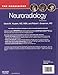 Neuroradiology: The Requisites (The Core Requisites)