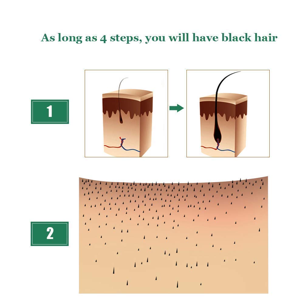 Hair Growth Serum, 2020 Hair Growth Treatment, Hair Serum, Anti Hair Loss, Thinning, Balding, Repairs Hair Follicles, Promotes Thicker, Stronger Hair, And Promotes Hair Regrowth : Beauty