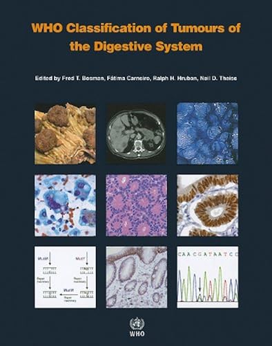 Download WHO Classification of Tumours of the Digestive System PDF