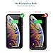 Kioson Battery Case for iPhone Xs/X [5200mAh], Rechargeable Protective Portable Charging Case for Apple iPhone Xs & X Extended Charger Pack Power Bank - Black