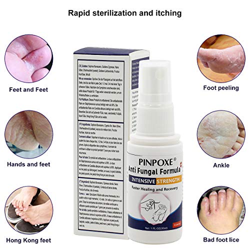 Antifungal Spray, Anti Fungal Foot spray, Natural formula ,Athletes