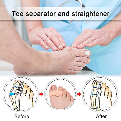 Skyfoot’s Toe Separator for Bunion with 2 Loops - Toe Spreader Gel Toe Corrector Pack of 6 (Beige)