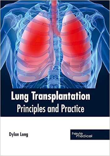 Lung Transplantation: Principles and Practice Lung Transplantation: Principles and Practice