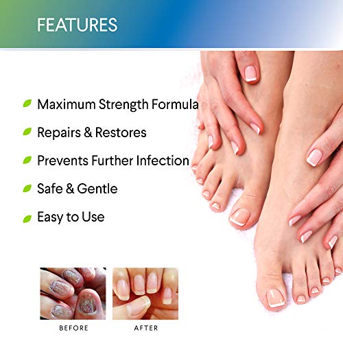 Fungus Stop Nail Repair Pen Toenail Fungus Treatment Fungus Nail Care