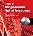 Atlas of Image-Guided Spinal Procedures E-Book