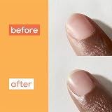 essie Apricot Nail and Cuticle Oil Treatment 13.5 ml Roll-On view 8