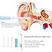 USB Ear Otoscope, Earwax Cleaning Endoscope 1.3 Megapixels HD 720P Ear Inspection Camera with Ear Wax Removal Tools Kits for Android Windows Made by ACELIST