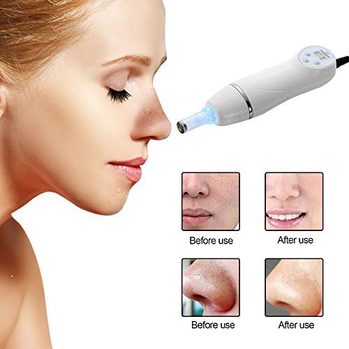 Facial Diamond Peeling Microdermabrasion Machine, Suction Blackhead and Acne Remover, Vacuum Cleanser for Skin Care