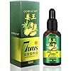 Ginger Germinal Oil, Hair Growth Oil, Hair Growth Serum, Ginger Germinal Essential Oil, Hair Loss Treatment Hair Care…