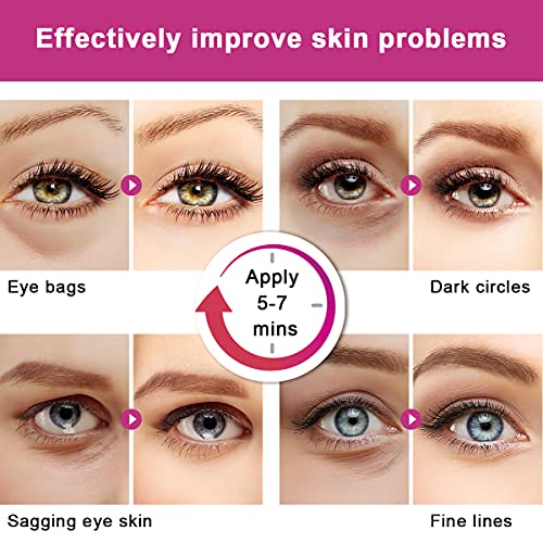 AICHUN Snail Under Eye Patches,Eye Collage Mask Treatment for Eye Bags