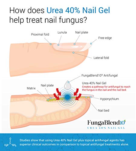 Cure Fungus Faster - Urea 40% Nail Gel - Delivers Antifungal Medication Directly to Fungus - Quick Results