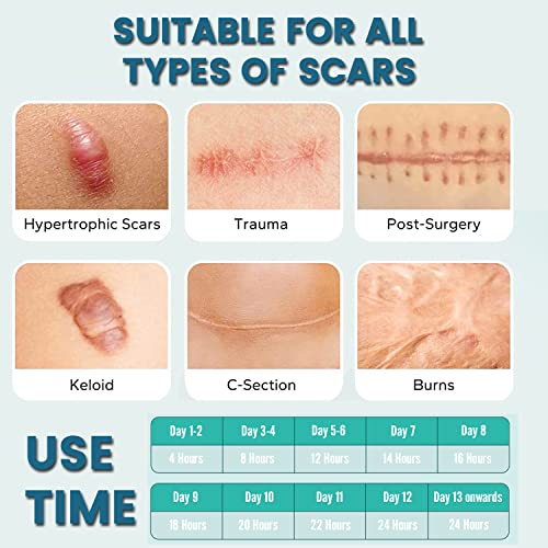 Silicone Scar Sheets (2 Rolls), Medical Grade Silicone Scar Tape, Scar Removal Strips for Acne, Burn Scars C-Section & Keloid Surgery Scars Sheets Treatment Sheets - 8 Month Supply