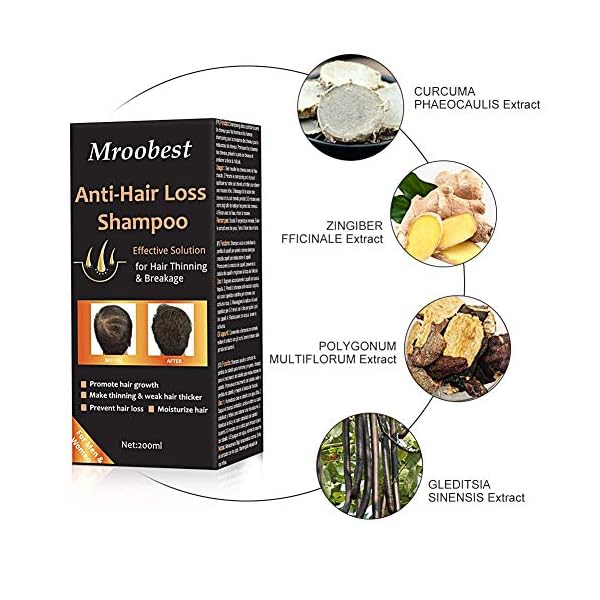Anti-Hair Loss Shampoo, Hair Growth Shampoo, Effective Solution for Hair Thinning & Breakage, Helps Stop Hair Loss, Grow…