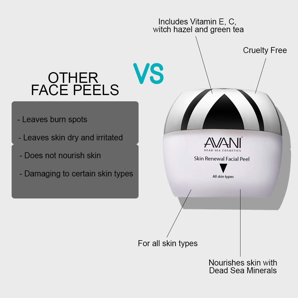AVANI Classics Skin Renewal Facial Peel | Enriched with Vitamins E & C | Infused with Dead Sea Minerals - 1.7 fl. oz. (Single): Beauty