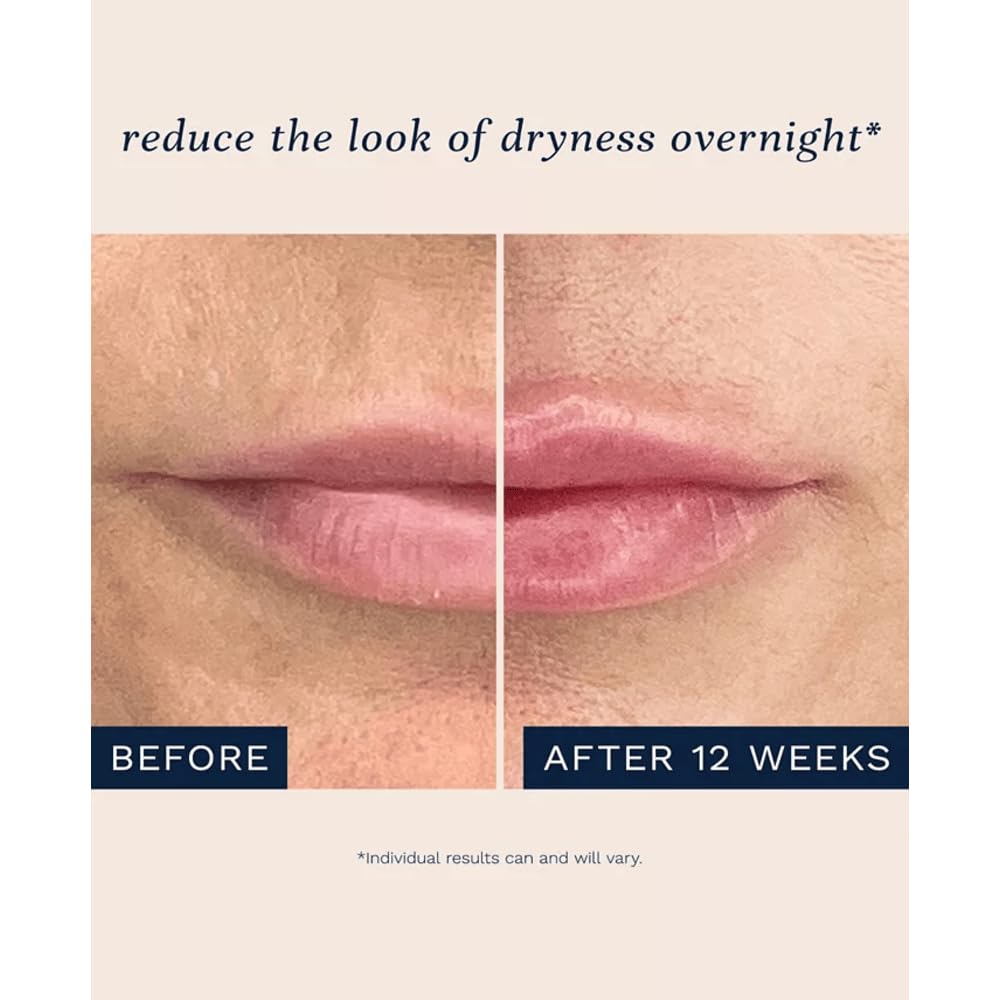 City Beauty City Lips Night Oil - Plump, Hydrate, and Restore Overnight - Anti-Aging Lip Treatment - Conditioning Lip Oil with Hyaluronic Acid & Plant Extracts