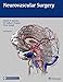 Neurovascular Surgery