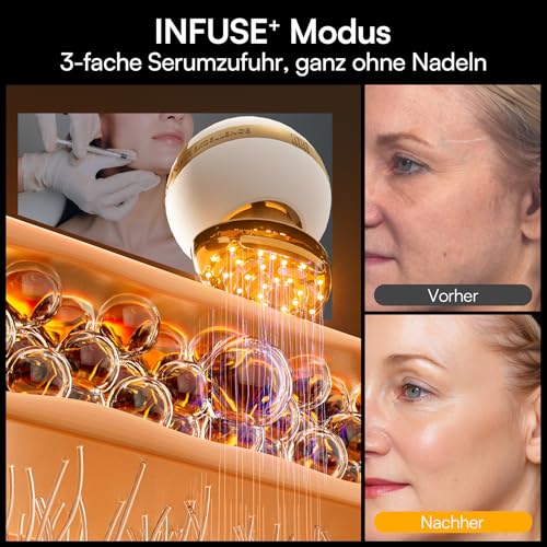 INIA SPHERA Improved 8-in-1 Microcurrent Face Massager for Face & Neck - Red Light, Heat & Cooling Function, 5 Modes, Beauty Tool for Defined and Radiant Skin at Home