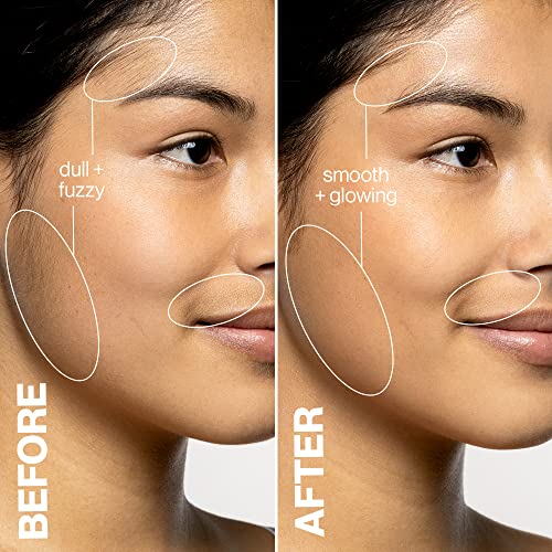 DERMAFLASH â€“ LUXE Device â€“ Exfoliating, Hair Removal (Icy Pink) , 1