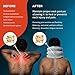 NeckFix Cervical Neck Traction Device ✮ Instant Neck Pain Remedy at Home ✮ Inflatable & Adjustable Neck Stretcher Collar Device - Gray