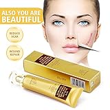Acne Scar Removal Cream, Skin Repair Cream Scar Cream Gel Scar Treatment for Face and Body Scar Acne Spots Stretch Marks 30ml