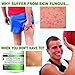 Dr. Cole’s Organic Herbal Skin Fungus Soaking Salts – May Assist with Skin Fungus Infections, Jock Itch, Athlete’s Foot, etc