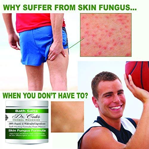 Dr. Cole’s Organic AntiFungal Skin Soaking Salts Extra Strength