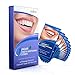 Anjou Teeth Whitening Strips, Professional 14 Sets 28 Pieces Whitestrips Kit, Remove Stains & Freshen Breath with Mint Flavor, Lead to 3D Dental Whiter Teeth in just 14 Days