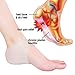 Heel Protectors- PURENJOY Heel Protective Sleeve & Heel Spur Pads for Relief Plantar Fasciitis & Heel Pain, Reduce Pressure on Heel, Cracked Heel with 100% Soft Flexible Silicone-4 Pieces