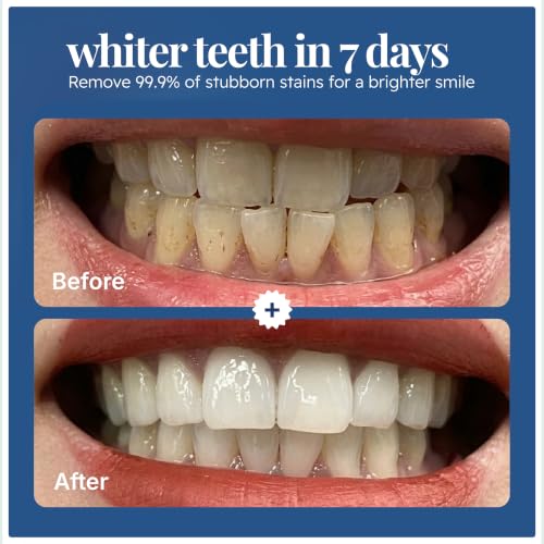 EcoBrightSmile Teeth Whitening Powder – Dentist Approved – Removes Years of Coffee, Tea & Ageing Stains – Enamel Safe Tooth Whitening, Peroxide-Free Stain Remover, Teeth Whitener with Hydroxyapatite