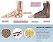 Thx4COPPER Plantar Fasciitis Socks with Arch Support,15-22mmHg Compression Foot Sleeve for Ankle & Heel Support, Reduce Swelling & Relieve Pain,Speed Up Recovery (1 Pair) …