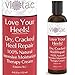 Dry, Cracked Heel/Foot Care & Repair (Anti Aging) - Intensive Moisturizer & Treatment Cream w Shea Butter & Beeswax - All Natural - 'LOVE Your Heels!' 4.46oz